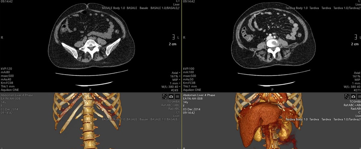 Dinamik Kontrastlı BT Tetkikleri